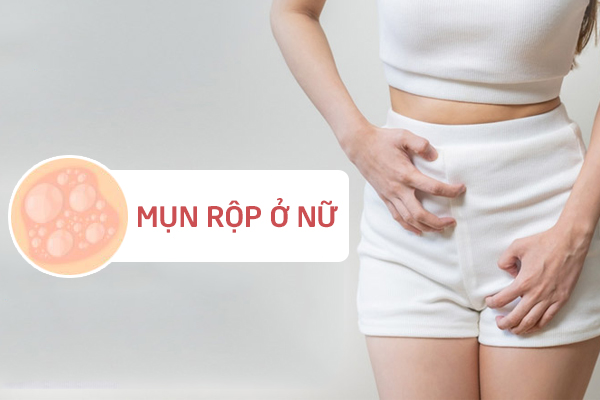 Hình ảnh mụn rộp sinh dục ở nam và nữ