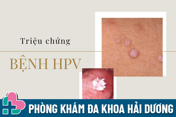 nhung-thong-tin-tong-quan-benh-hpv-can-biet-3