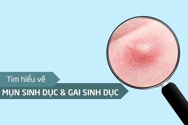 Phan-biet-mun-sinh-duc-va-gai-sinh-duc-7