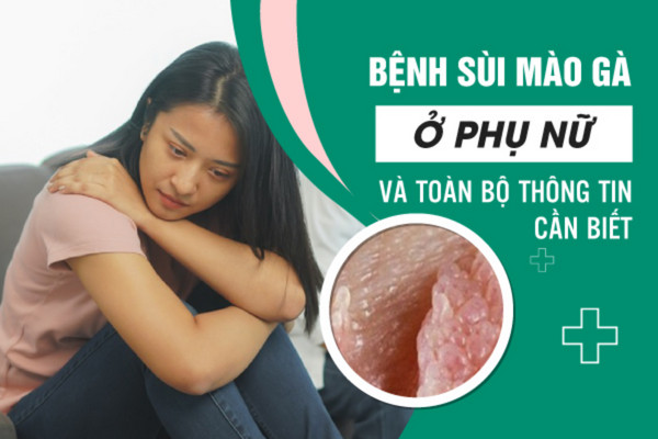 Bệnh sùi mào gà ở phụ nữ và toàn bộ thông tin cần biết