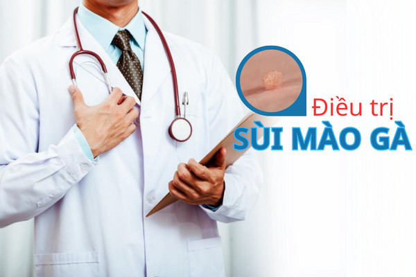 Biện Pháp Nào Điều Trị Sùi Mào Gà Tối Ưu?