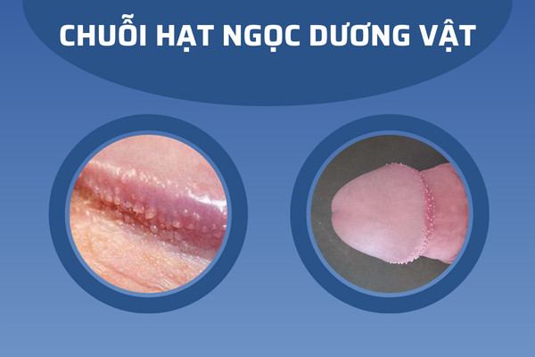 Z5261130896843_bc7646bc9718d78e3a6565e01a981a0a