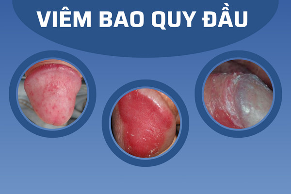 Z5261130902264_aa035b1d1cb613acf0495db7f9dc2af8