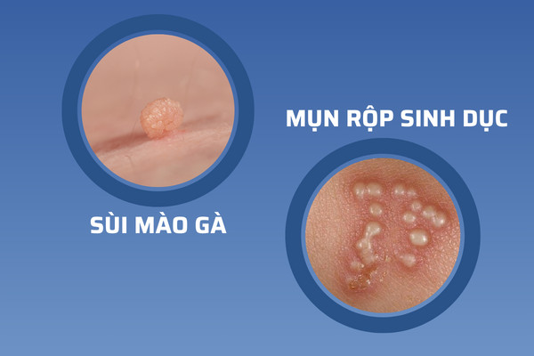 Z5261130921920_905eeb7d4f3bba3e1a5b06162d376c35