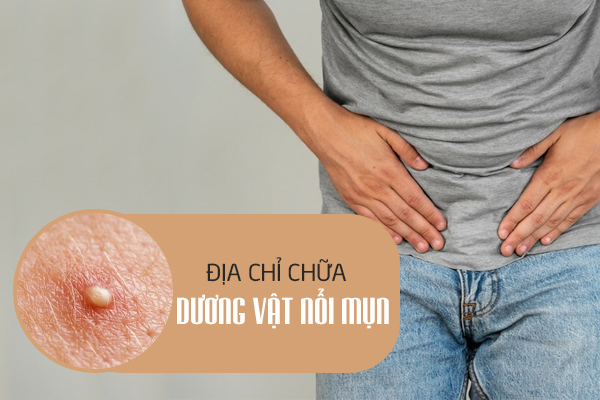 Nguyên nhân và địa chỉ chữa dương vật nổi mụn hiệu quả 
