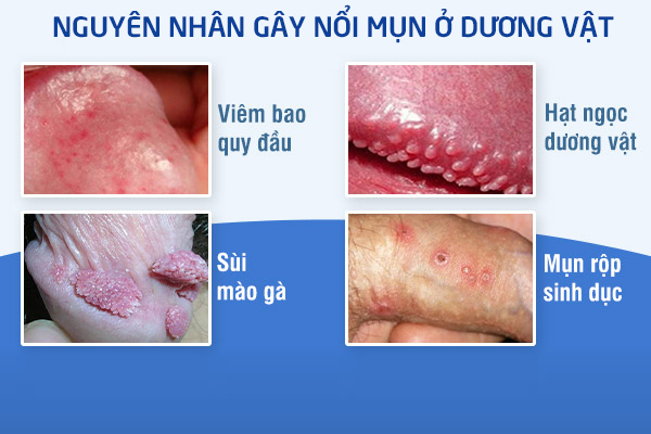 dia-chi-chua-duong-vat-noi-mun