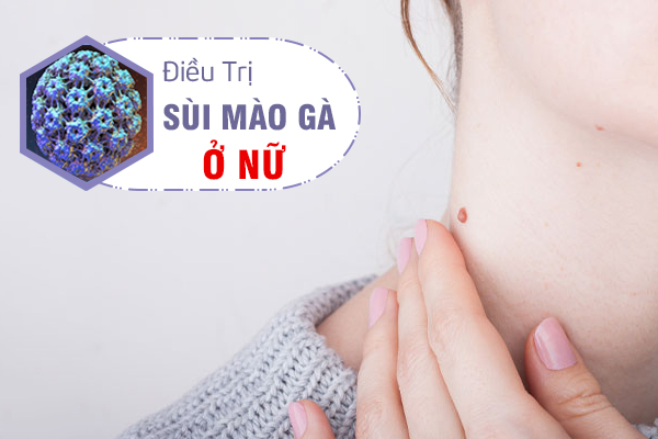 Dấu hiệu nhận biết và cách điều trị sùi mào gà ở nữ 