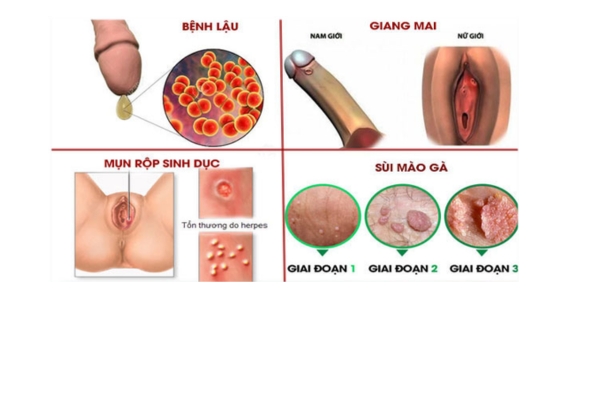 cac-benh-xa-hoi-thuong-gap