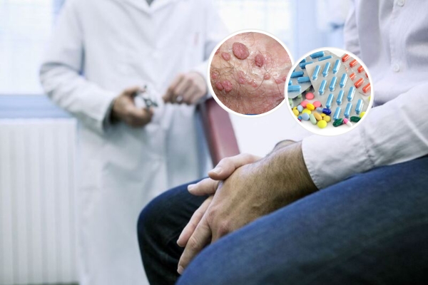 Phương pháp điều trị sùi mào gà ở nam và nữ