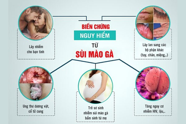 bien-chung-sui-mao-ga