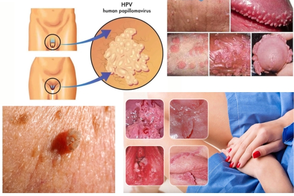 sui-mao-ga-nam-nu-dau-hieu-la-gi