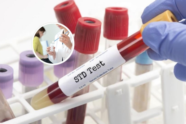 Phương pháp xét nghiệm bệnh xã hội hiệu quả và an toàn