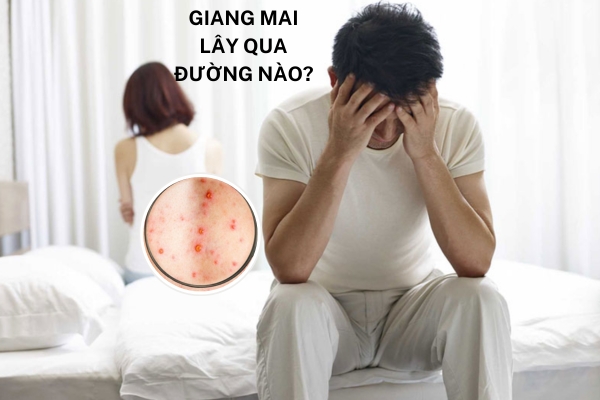 Chuyên gia giải đáp: Giang mai lây qua đường nào?