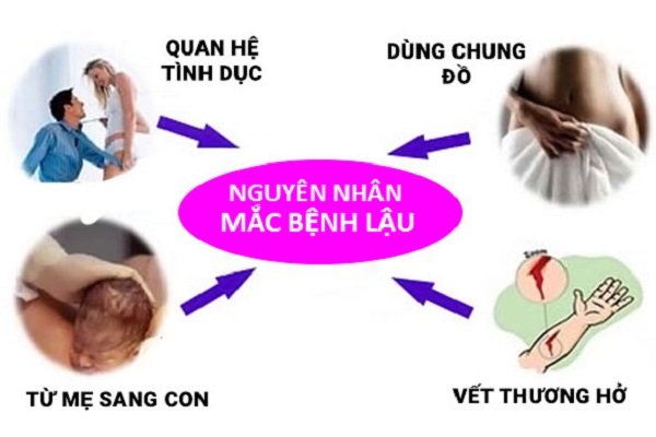Bệnh lậu có lây không và lây qua đường nào?