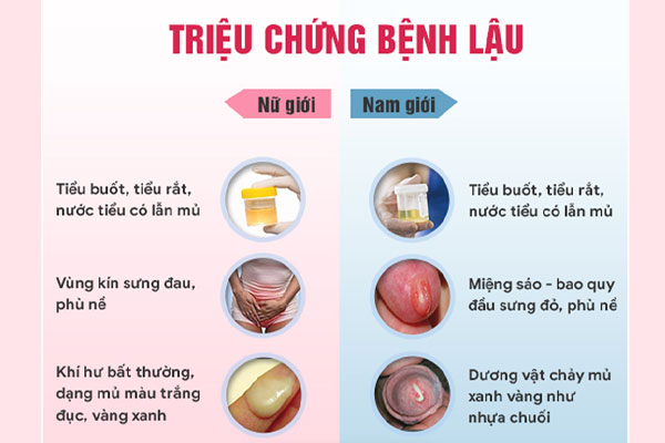 can-trong-voi-tieu-ra-dich-dau-hieu-benh-lau-dang-tan-cong