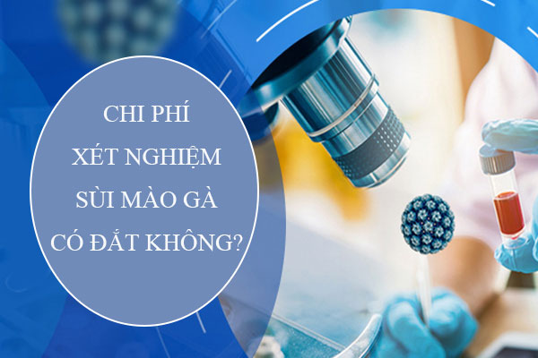 Chi phí xét nghiệm sùi mào gà có đắt không? Địa chỉ uy tín có mức giá ưu đãi