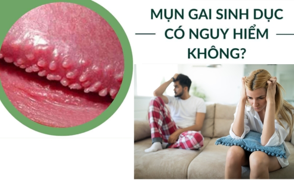 Gai sinh dục có nguy hiểm không? Khi nào cần đi khám ngay?
