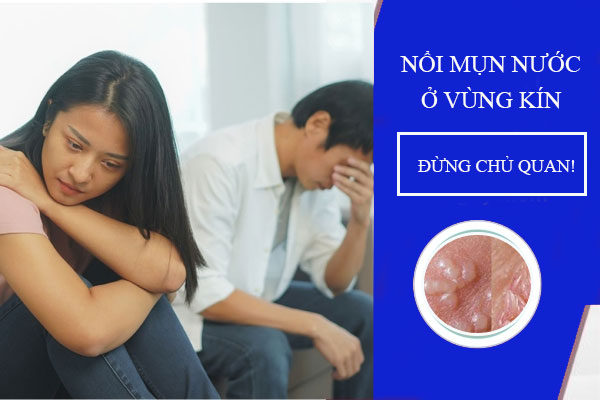 Nổi Mụn Nước Ở Vùng Kín: Nguyên Nhân Và Cách Điều Trị