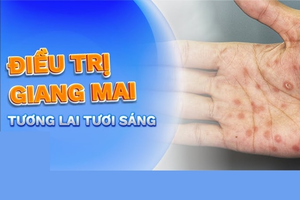 Phương pháp chữa giang mai nào hiệu quả? chi phí bao nhiêu?