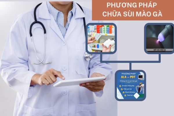Bật mí 5 phương pháp chữa sùi mào gà hiệu quả – nhiều người không ngờ tới!