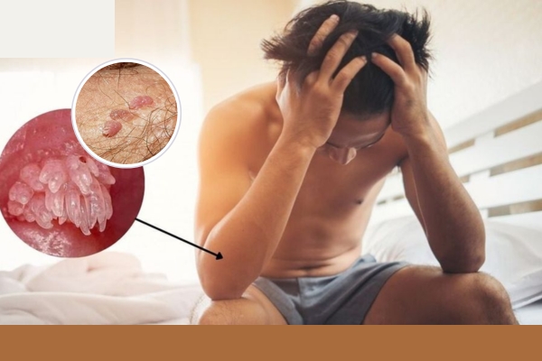 sui-mao-ga-o-vung-kin-nam