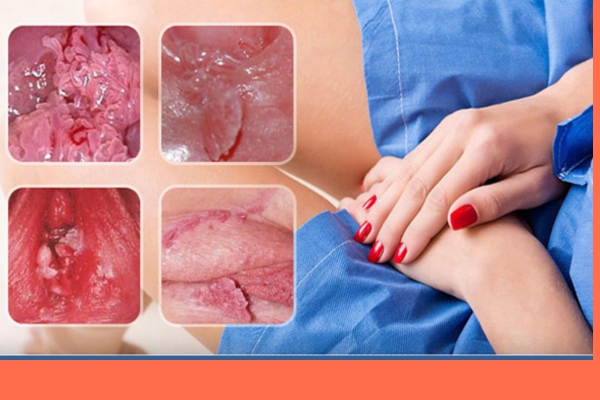 sui-mao-ga-o-vung-kin-nu