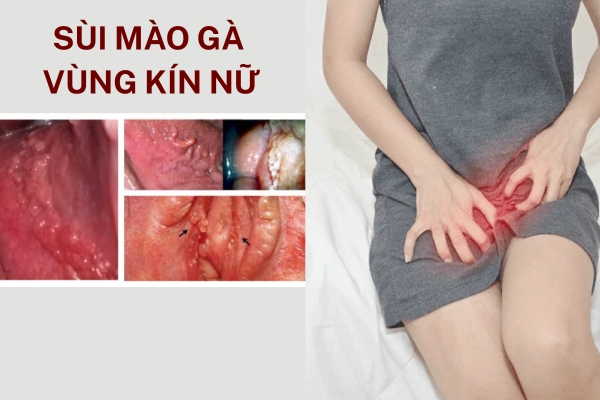 sui-mao-ga-vung-kin-nu