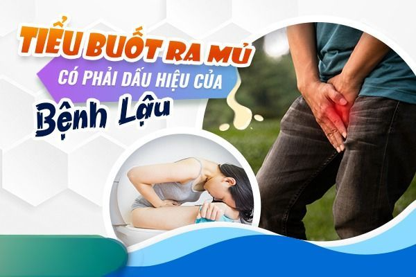Tiểu buốt có phải mắc bệnh lậu?