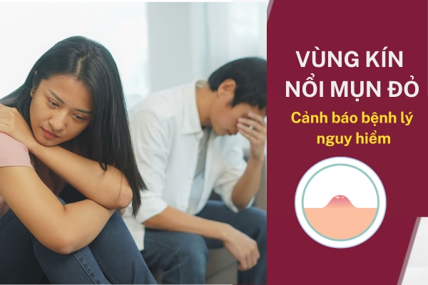 Vùng kín nổi mụn đỏ là bị bệnh gì nguy hiểm không?