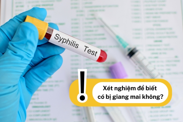 Xét nghiệm giang mai bằng phương pháp nào bao lâu có kết quả?